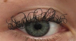 JAMA: patient grew long, curly eyelashes because of chemotherapy