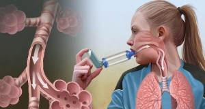 Железо может способствовать приступу астмы - исследование