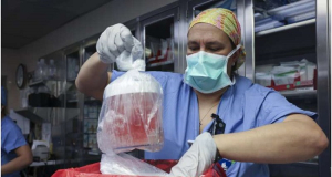 Умер первый пациент с пересаженной почкой генетически модифицированной свиньи