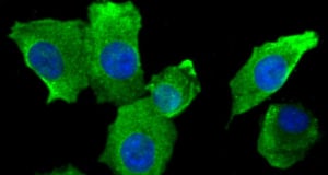 IVCDB: особый белок Sfrp1 связан с лекарственной устойчивостью рака