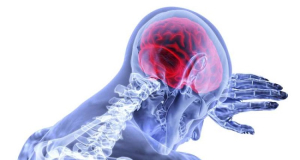 Stroke risk is considerably higher in people with multiple head injuries, study finds