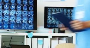 HealthDay: Healthy lifestyle keeps diabetes from aging the brain