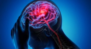 The Lancet Neurology: Ежегодно от инсультов во всем мире умирают 7 миллионов человек, и этот показатель растет