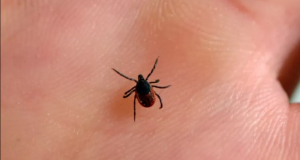 Young woman goes almost completely bald from tick bite