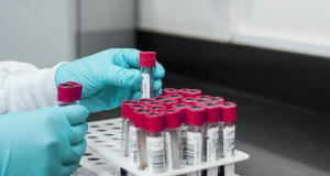 NatCom: A blood test has been created that detects minimal traces of cancer DNA