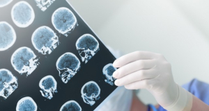 PLOS One: у людей, чьи родители развелись, шанс инсульта повышается на 61%