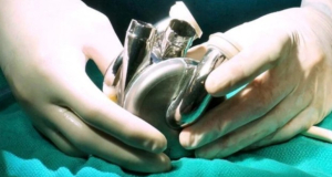 Australia man lives 100 days with titanium heart while waiting for donor transplant