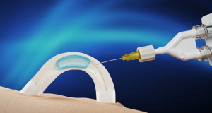 Implantable Non-Hormonal Male Contraceptive Developed, Effective for at Least Two Years