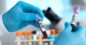 BMJ: Annual Blood Test May Help Detect Multiple Cancers at an Early Stage