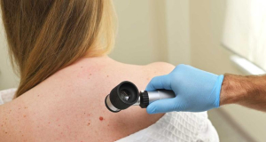 Cancer: common antibiotics can help defeat melanoma
