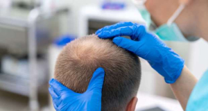 Scientists make historic breakthrough in baldness cure