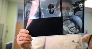 British professor says that cancer survival rates will increase fourfold