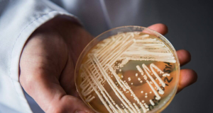 Medical Mycology: в Японии впервые выявлен опасный грибок, устойчивый к лечению