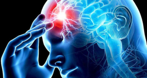New Drug Reduces Brain Damage After Stroke by 60%
