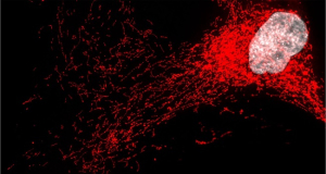 Nature Communications: Клетки‑&laquo;зомби&raquo; усиливают воспаление при тяжёлой форме жирового заболевания печени