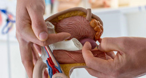 Journal of Urology: низкий уровень тестостерона провоцирует рост рака простаты
