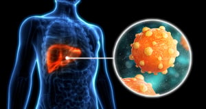 Acute Hepatitis B Reported in Fully Vaccinated Patient Due to Possible Vaccine-Escape Mutation