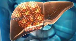 One Glass a Day: Study Identifies a Beverage That May Increase Liver Cancer Risk