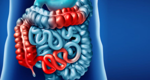 American Journal of Gastroenterology: Ultra-Processed Grain Products May Increase the Risk of Inflammatory Bowel Disease