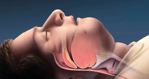 Journal of Clinical Medicine: Перенесенный COVID-19 усиливает реакцию дыхания после пробуждения во время сна