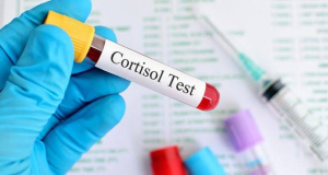 JAMA: High Salivary Cortisol Levels Are Associated With Memory Decline
