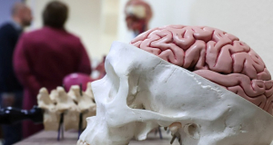 A&D: Residents of Two Amazonian Indigenous Communities Showed Unusually Low Rates of Dementia
