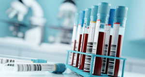 Lund University receives $19.4 million NIH grant to develop Alzheimer&rsquo;s blood test