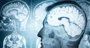 PNAS: The right hemisphere of the brain ages faster than the left