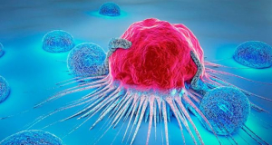 Study: One in Eight Cancer Cases Worldwide Is Linked to Preventable Infections