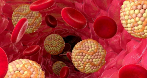 bioRxiv: холестерин может мешать мозгу избавляться от токсичных белков